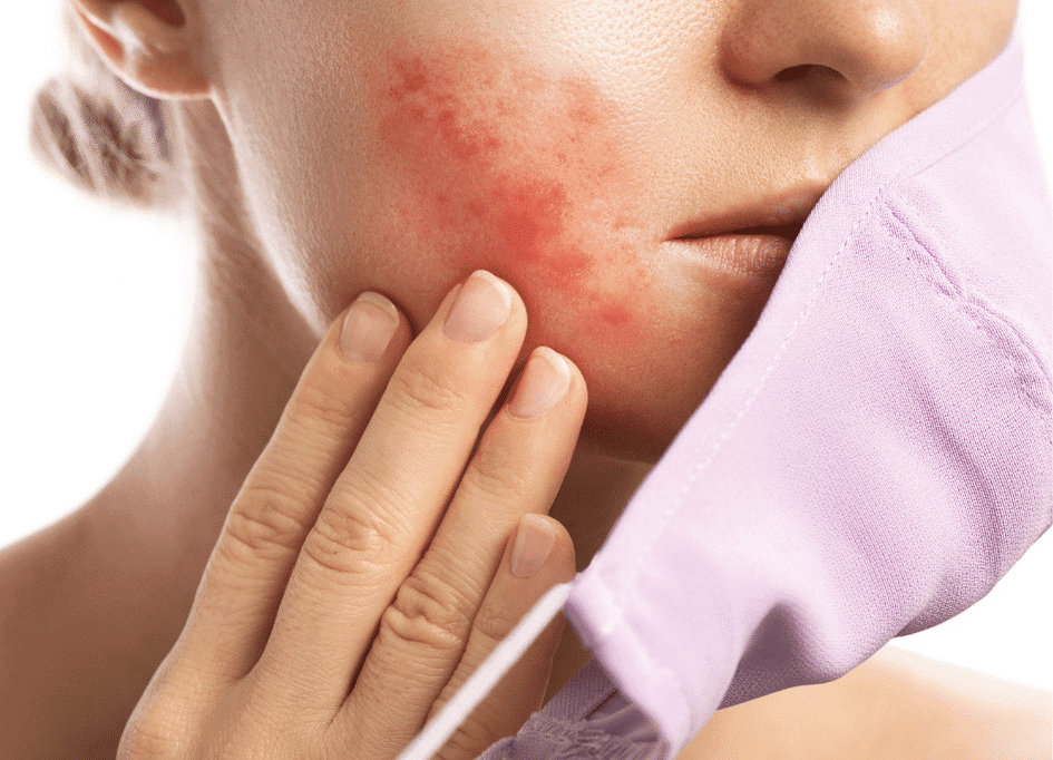 A person with red skin irritation on the cheek touches their face, holding a purple mask away. They consider the benefits of red light therapy for skin health, pondering how it might soothe their irritation and rejuvenate their complexion.
