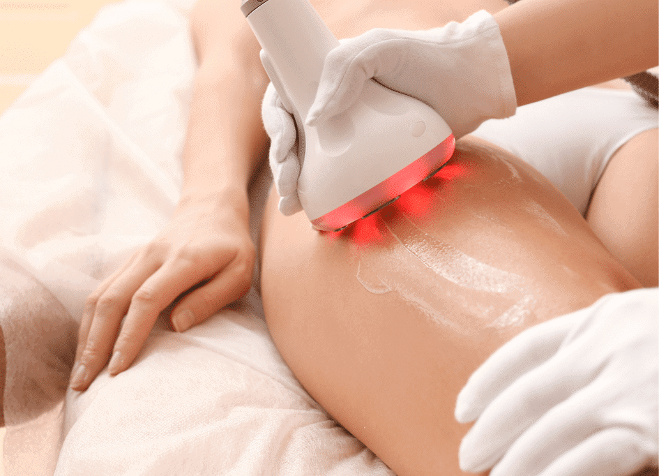 A person receives a soothing laser treatment on their thigh while lying down. The laser device emits rejuvenating red light, and the operator wears white gloves. This session highlights the benefits of red light therapy for anti-aging, promoting healthier, youthful-looking skin.