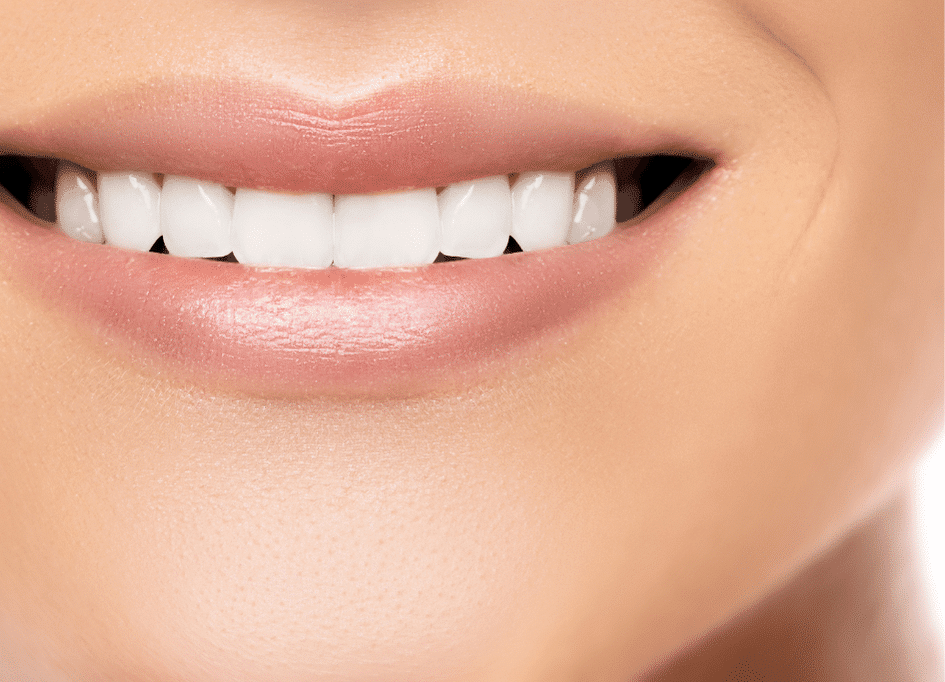 Close-up of a person smiling, showcasing straight, white teeth and smooth, light-colored lips, possibly benefiting from red light therapy for skin health and improved appearance.