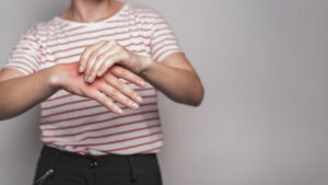 natural rheumatoid arthritis treatment