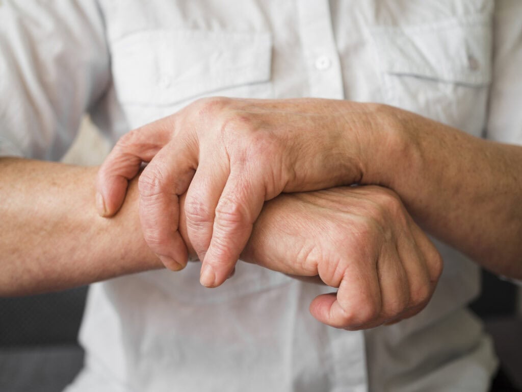 rheumatoid arthritis treatment