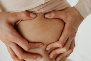 Can Red Light Therapy Remove Stretch Marks and Cellulite